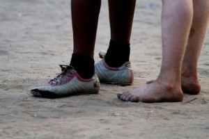 A mob in Malawi burned seven men to death for allegedly possessing human albino bones for use in witchcraft. Albinos, who have white skin and yellow hair as a result of a genetic disorder, are regularly killed for their body parts, which are used in witchcraft rituals in African countries including Malawi, Mozambique and Tanzania. Photo: AFP/Getty Images