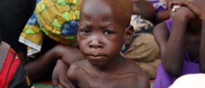 malnourished-nigerian-child-817x350