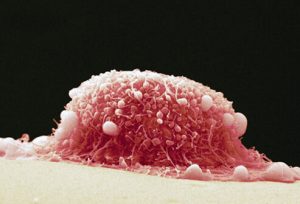 cervical-cancer-s1-photo-of-hela-cell