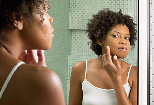 black-woman-acne-skin